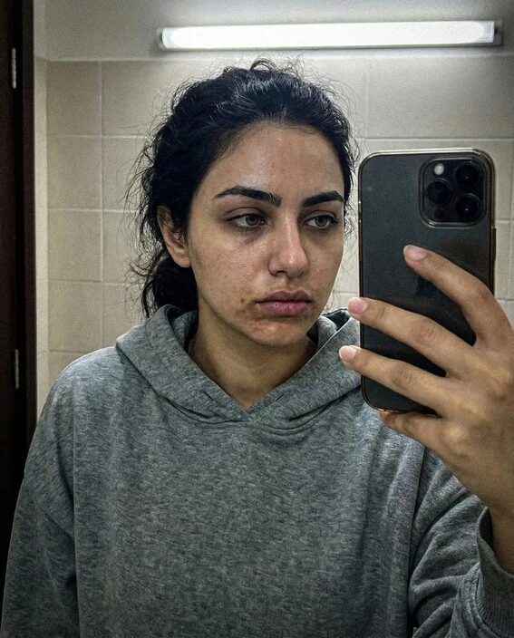 امرأة تشعر بالإحباط من بشرتها