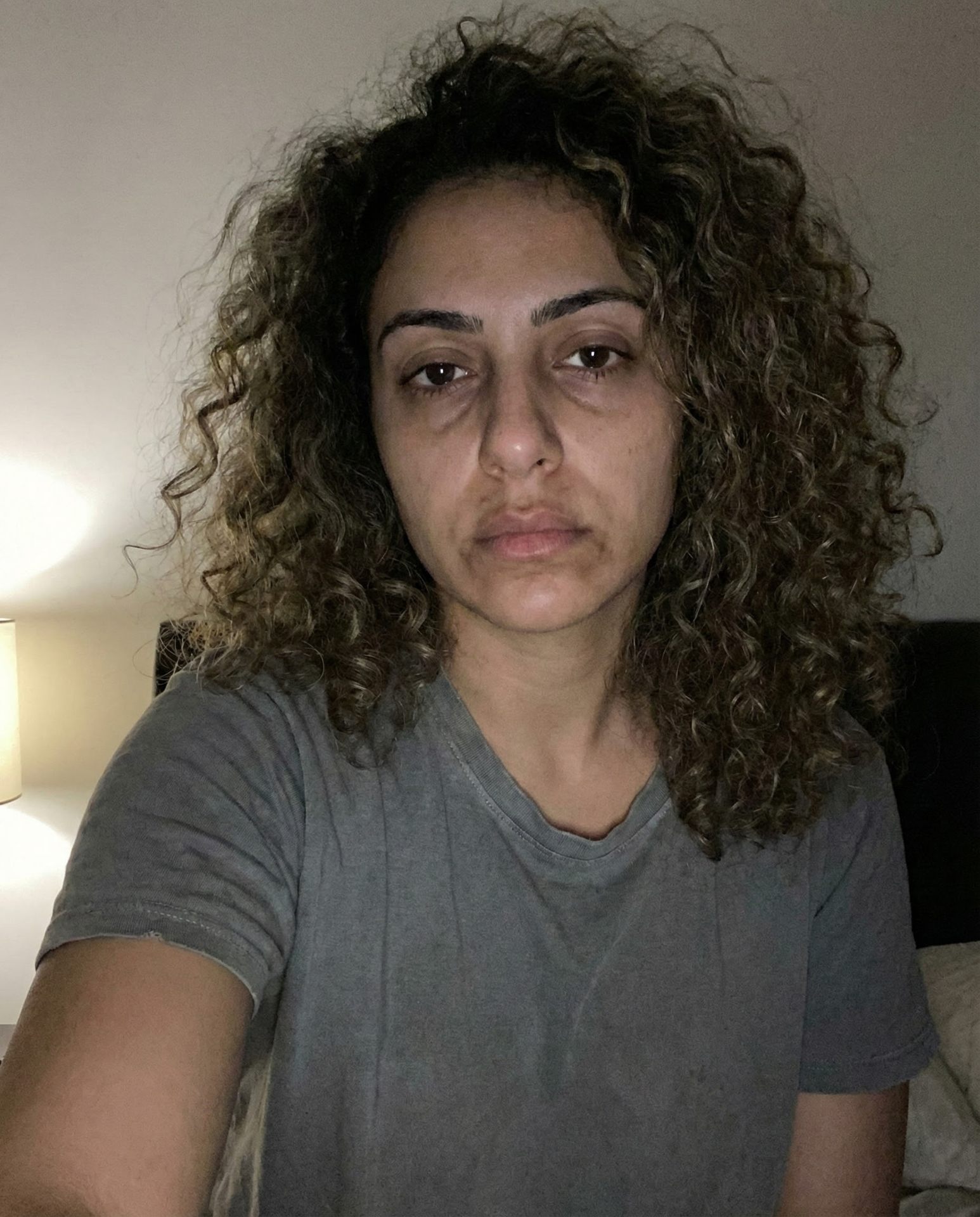 قبل - بشرة غير موحدة