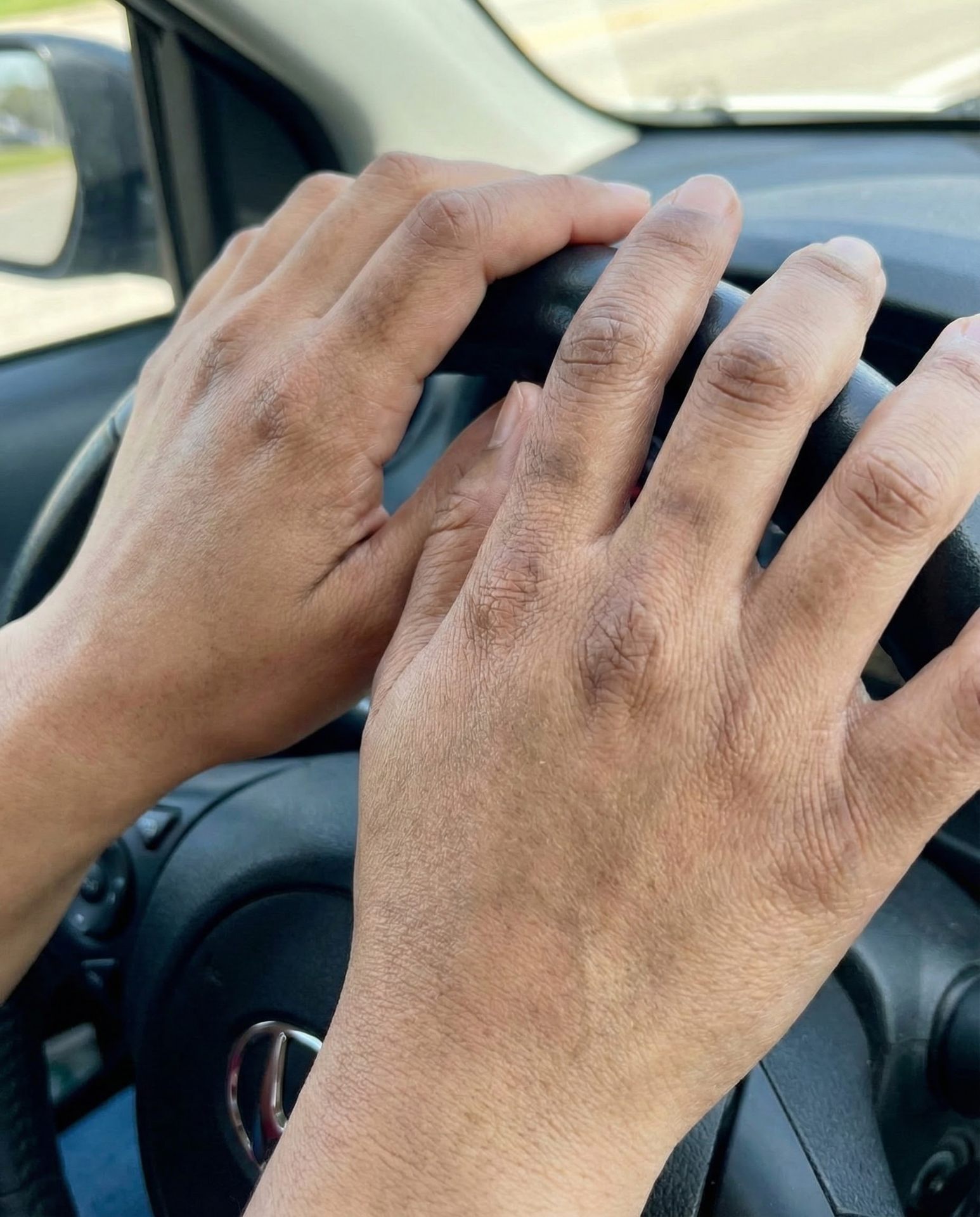 قبل - لون غير موحد