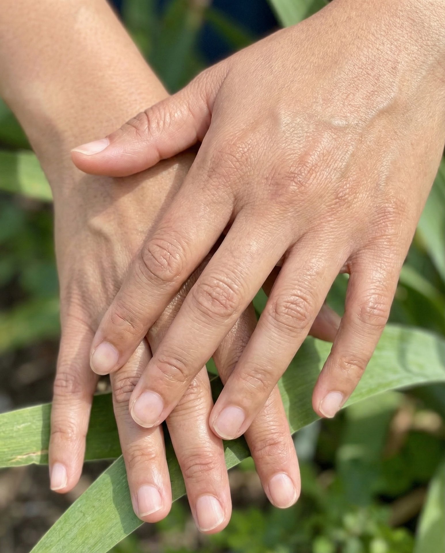 بعد - بشرة ناعمة موحدة